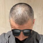 おしゃれ坊主にしました！